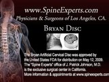 Bryan Artifical Cervical Disc * Replaces diseased or bulging cervical disc causing neck or arm pain