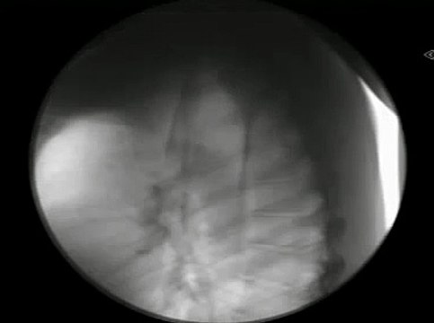 Moving X-ray INSIDE Sword Swallower Swallowing 7 swords on Stan Lee's Superhumans-aMc6-gJJWRA