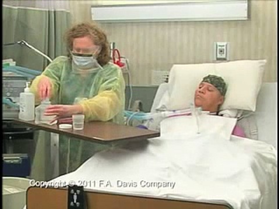 Suctioning Tracheostomy, Open System.mp4