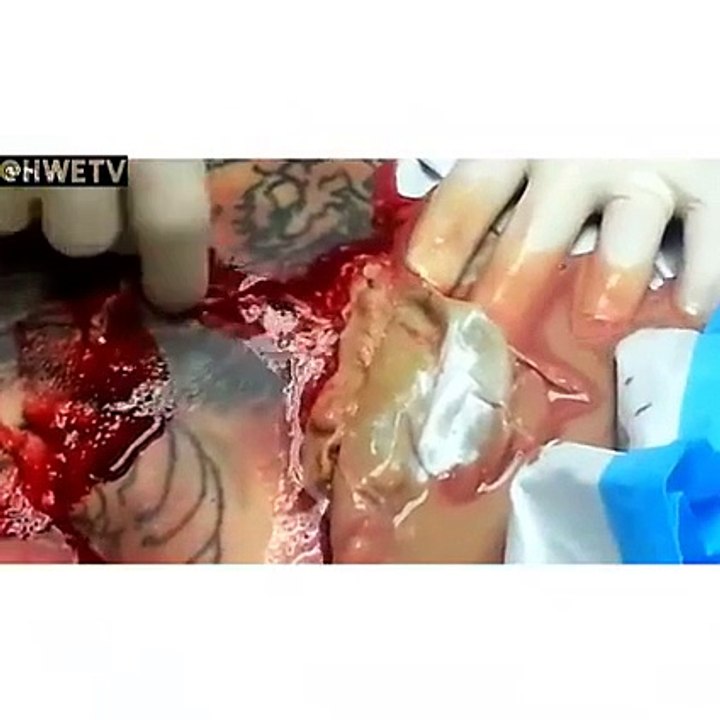 يا لطيف شنو هذا ؟ أصحاب القلوب الضعيفة ما تتفرجوش خير...