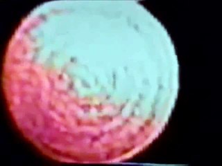 Actual appearance of Alien (Demon) Right Before Abduction