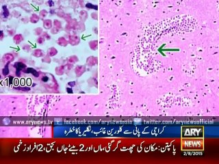 Naegleria spreading rapidly in Karachi