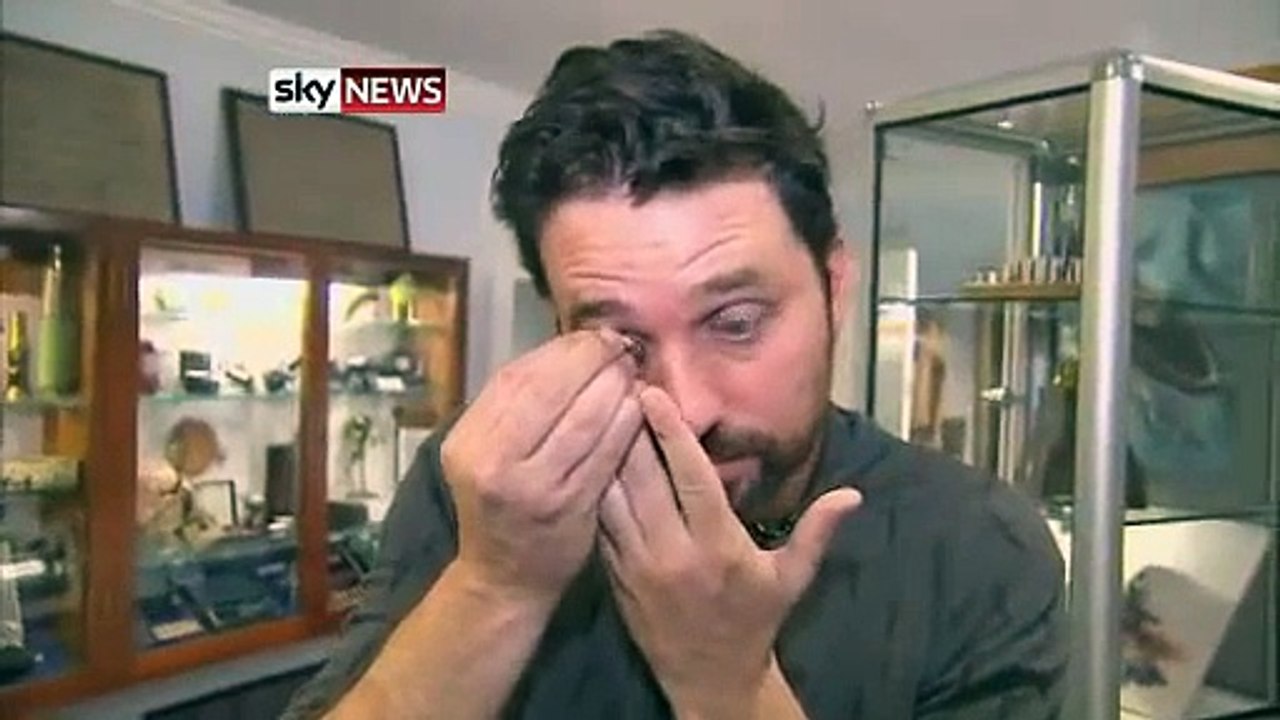 Eyeborg Man Rob Spence Fits Video Camera Into Prosthetic Eye   Technology   Sky News