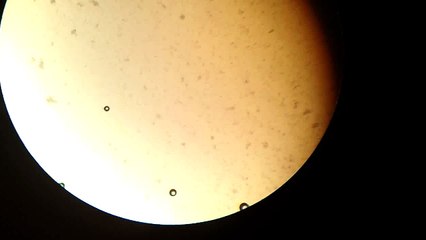Observación de levaduras en microscopio óptico