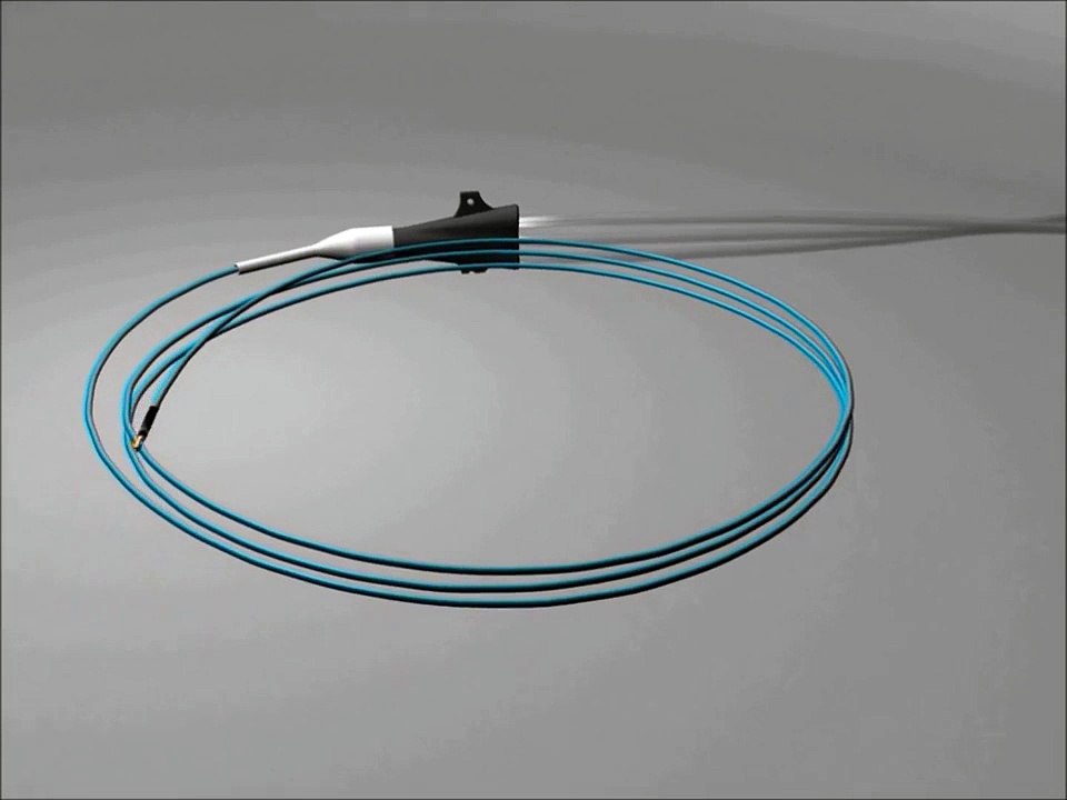 Syracuse University - NeuroFlow Rapid Exchange Catheter