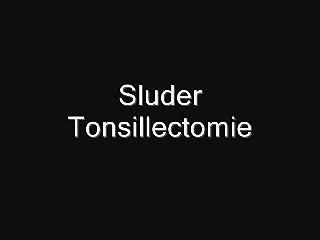 Sluder Tonsillectomy - Keelamandelen verwijderen