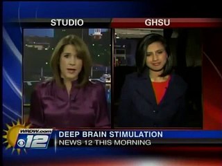 Successful DBS surgery for Dystonia patient