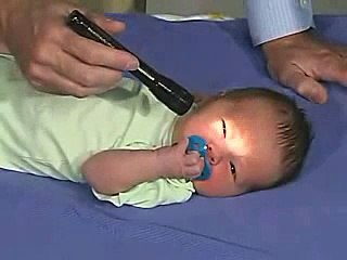 ImedrxTv The Video Blog University of Utah Pediatric Neurological Examination Normal Newborn