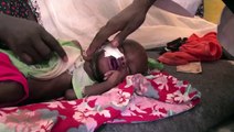 Somalia, malnutrizione: una corsa contro il tempo