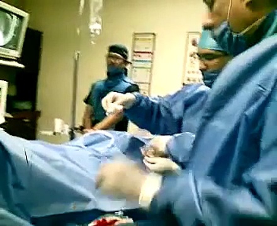 CATETERISMO CARDIACO POR LA ARTERIA RADIAL
