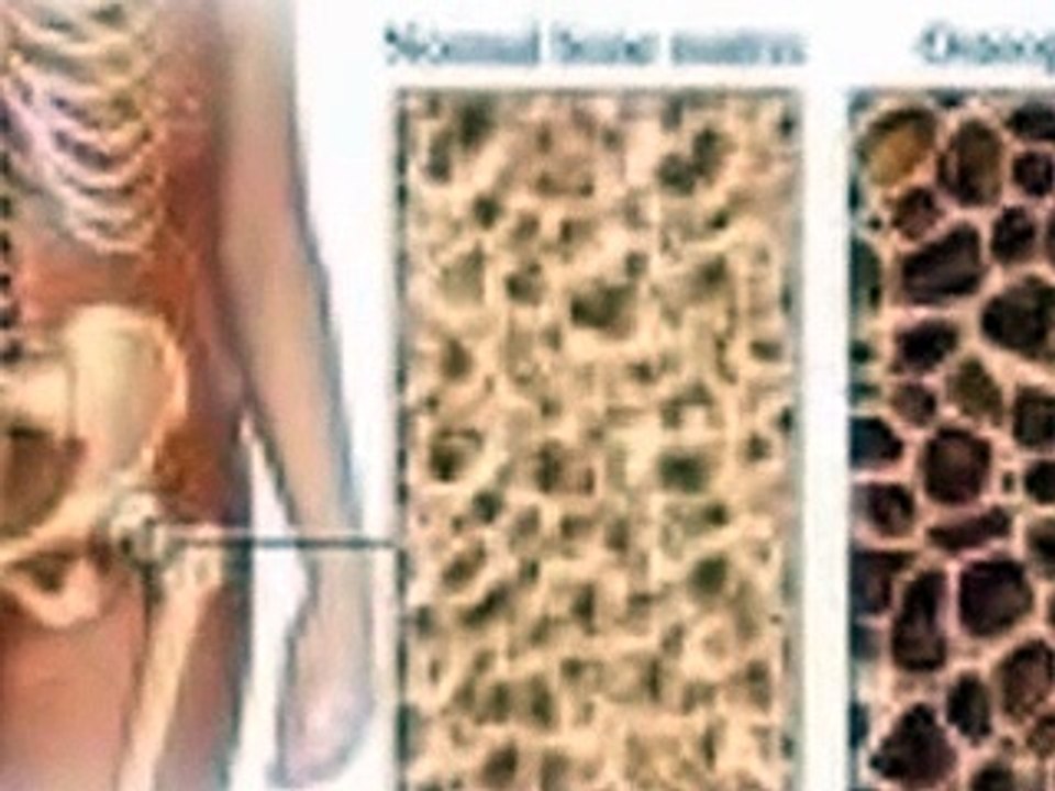 Dangers of drinking cow's milk
