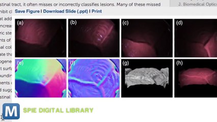 New Light-Based Detector Spots Cancer Faster