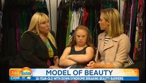 Goodlife trainer helps aspiring model with Down Syndrome stay fit and healthy