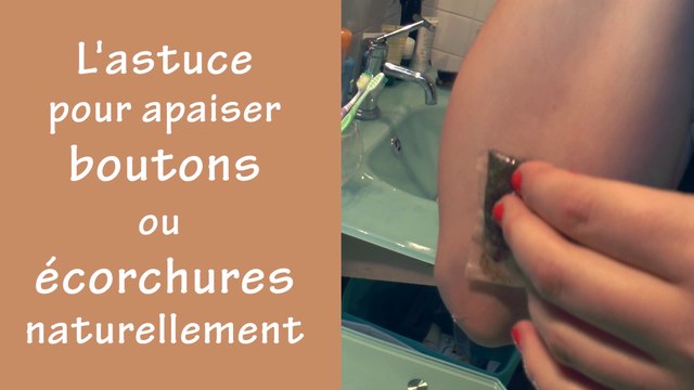 L'astuce pour apaiser boutons ou écorchures naturellement