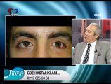 BLOW OUT Orbita kırığı cerrahisi | Prof Dr Kadircan Keskinbora