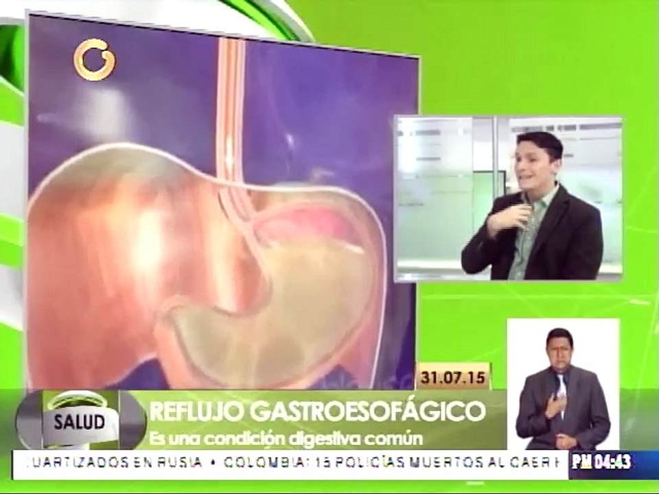 Conozca el tratamiento para el reglujo gastroesofágico