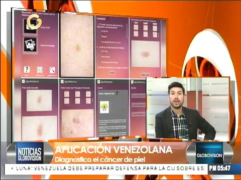 La aplicación móvil capaz de detectar cáncer de piel