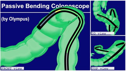 COLONOSCOPY Olympus Total