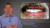 Don't Buy DENTURES | You have another Choice