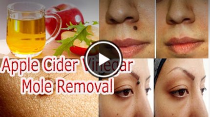 Apple Cider Vinegar Mole Removal