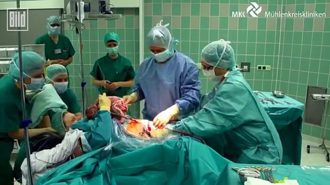 Mutter zieht ihr Baby bei Geburt selbst aus dem Bauch