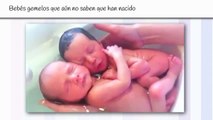 Bebés gemelos que aún no saben que han nacido
