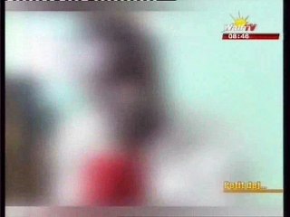 Témoignage d'un homme dont la fille a été  a versé de l'eau chaude