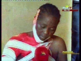 Témoignage d'une femme à qui on a versé de l'eau chaude