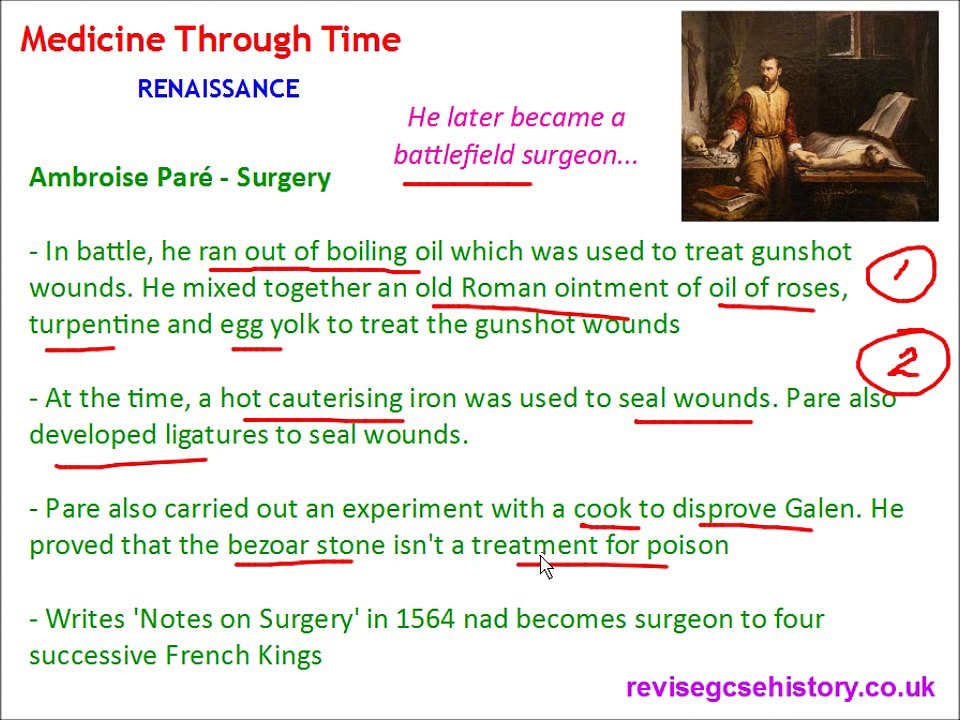 Medicine Through Time - Renaissance - The Work of Vesalius, Pare and Harvey