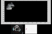 Omnidirectional visual odometry and mosaicing