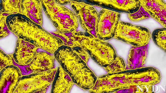 Fast Facts on Legionnaires' disease