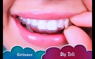 Görünmez diş telleri ile çarpık dişler nasıl tedavi edilir ? Diş teli nasıl takılır ? ALPDENT DENTAL GROUP