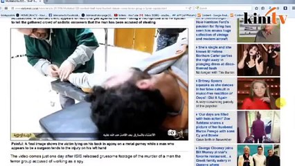 Militan IS potong tangan remaja yang mencuri