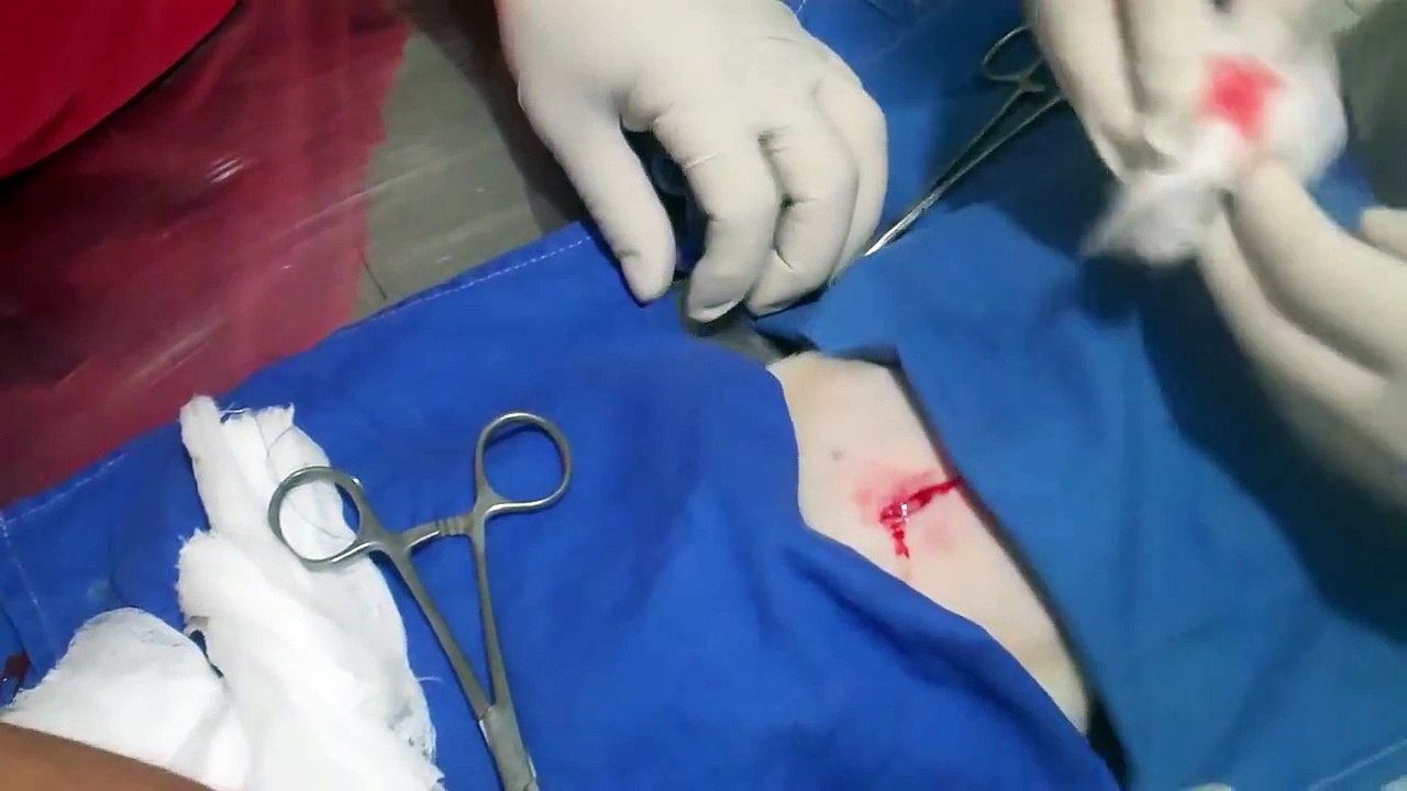 English bulldog puppy umbilical hernia surgery  Part 1