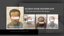 Video demonstration of FUE Hair transplant in Pakistan,Best quality hair transplant center in pakistan