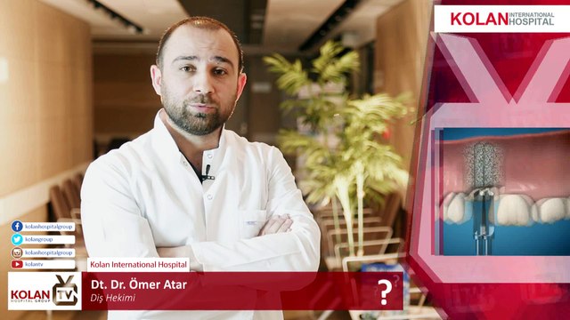 İmplant Tedavisinin Avantajları ve Dezavantajları Nelerdir ? - Dt.Dr.Ömer Atar