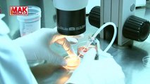 In Vitro Fertilization - Dr.Slobodan Lazarevski - Sistina, Macedonia