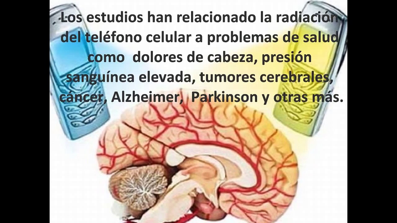 Daño causado por telefonos celulares y su solucion Winguard.avi