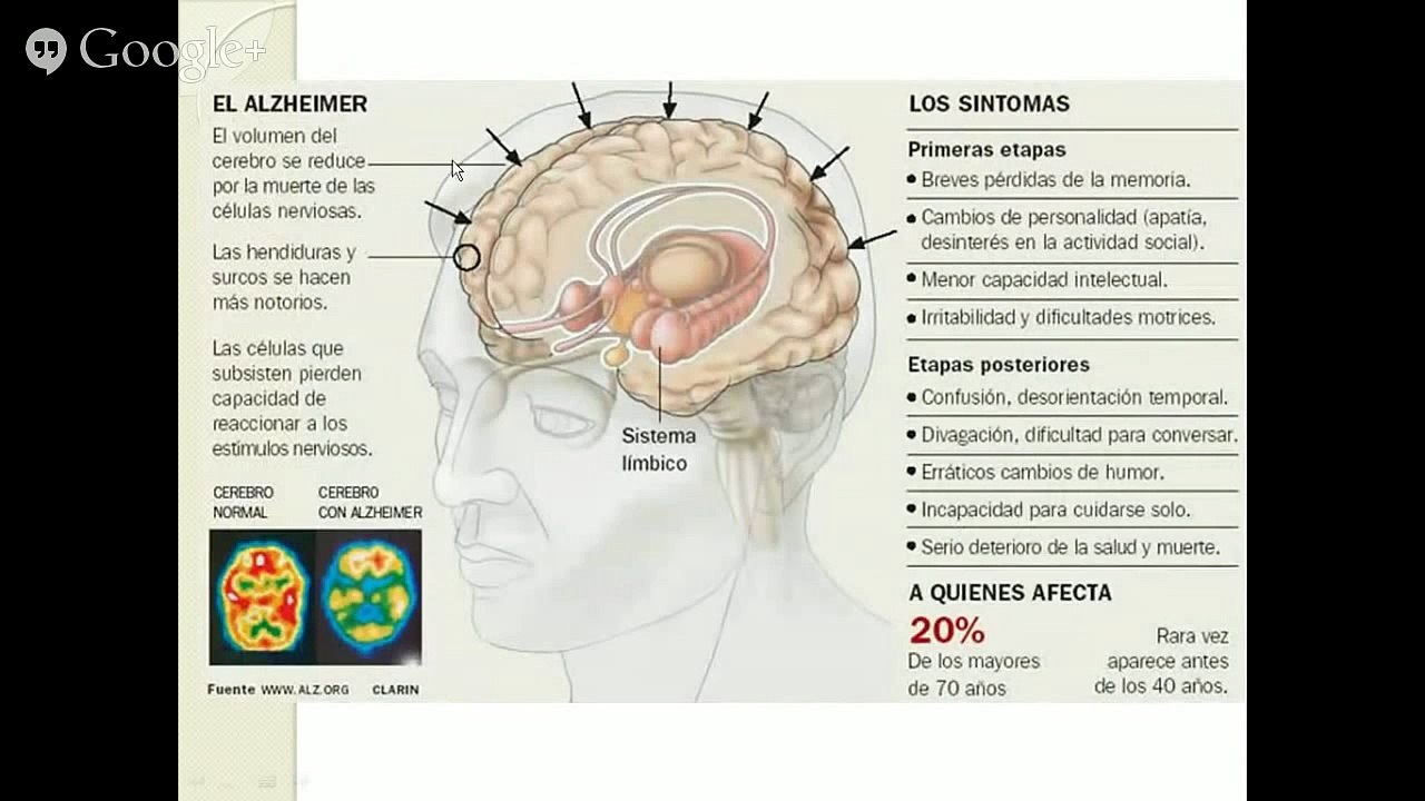 Factores de Transferencia para Alzheimer y Parkinson