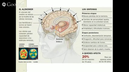Factores de Transferencia para Alzheimer y Parkinson