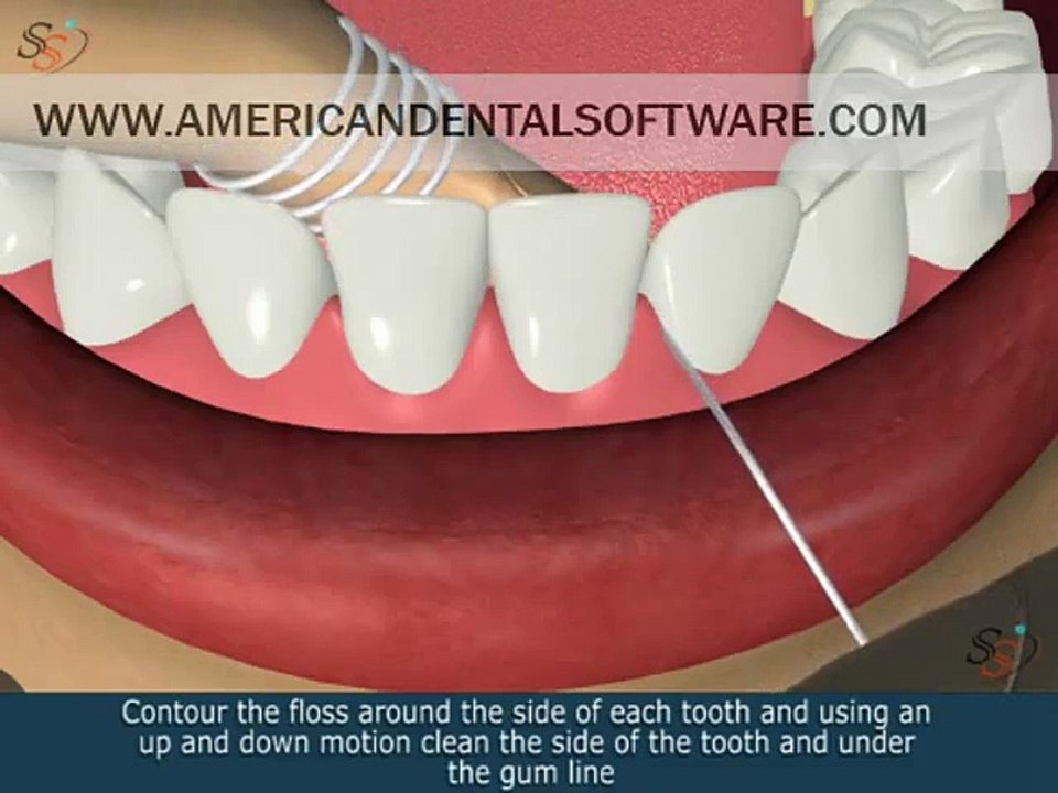 Dental Patient Education Flossing in 3D video