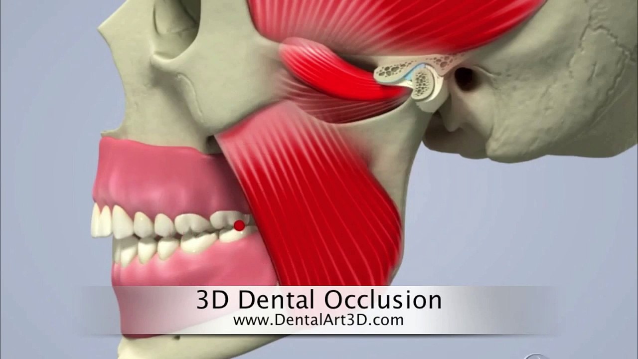 DentalArt3D. 3D Dental Occlusion