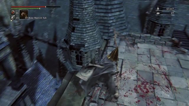 Why wearing cone-shaped metal hats are a bad idea.