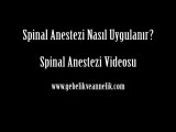Spinal Anestezi Videosu (Animasyon)