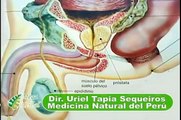cancer de prostata cura tratamiento psa remedio casero medicina uriel tapia 11