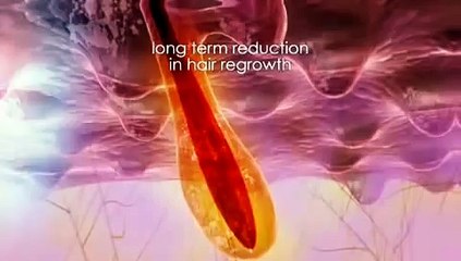 How To Use The NoNo Hair Removal System