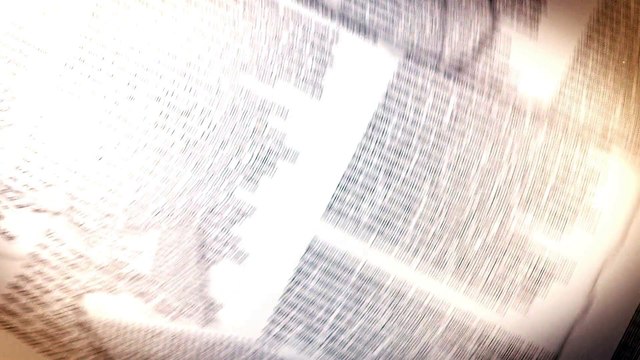 Personal Injury Lawyer Essex, MD | Personal Injury Attorney Dundalk, MD