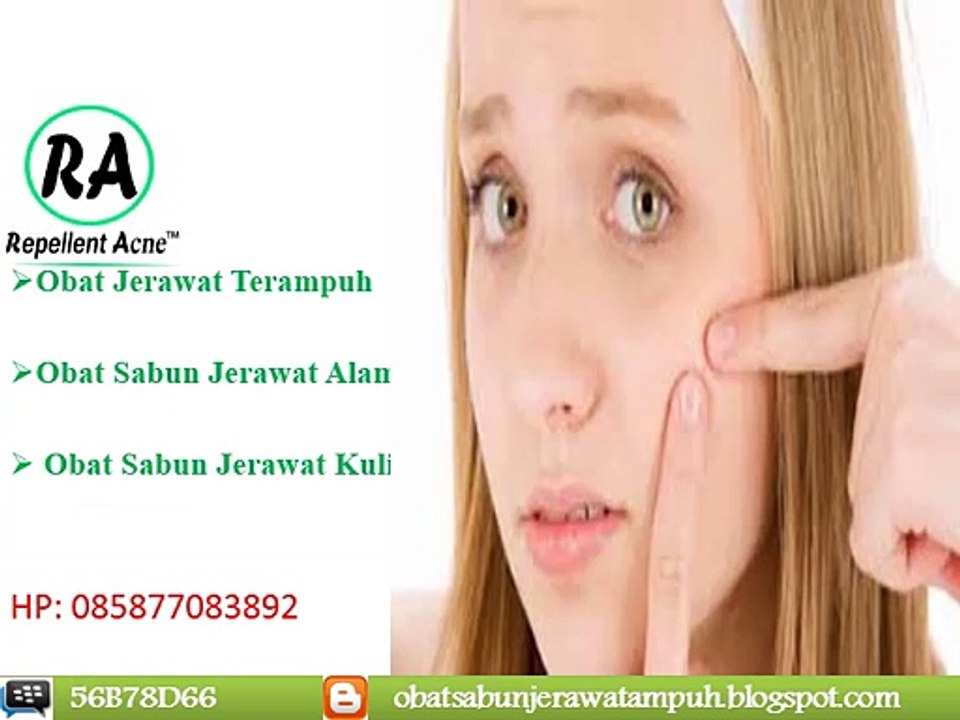 SMS 0858 7708 3892, Obat Penghilang Jerawat Punggung