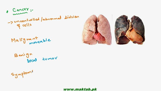 FSc Biology Book1, CH 13, LEC 13; Respiratory Disorders