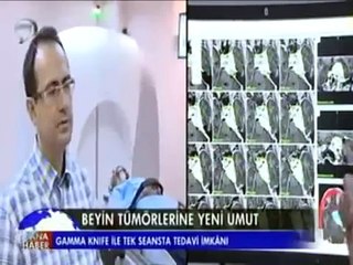 Prof. Dr. Gökhan Kurt Beyin Tümörleri ve Gamma Knife Tedavisini Anlatıyor